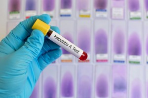 Hepatitis A test